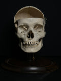 Medically Prepared Human Skull in Display Dome (AS-IS)