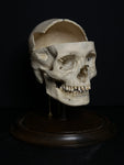 Medically Prepared Human Skull in Display Dome (AS-IS)