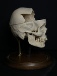 Medically Prepared Human Skull in Display Dome (AS-IS)