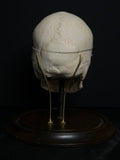 Medically Prepared Human Skull in Display Dome (AS-IS)