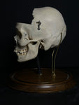 Medically Prepared Human Skull in Display Dome (AS-IS)