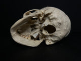 Medically Prepared Human Skull in Display Dome (AS-IS)