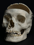 Medically Prepared Human Skull in Display Dome (AS-IS)