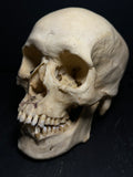Human Skull with Linear Enamel Hypoplasia (LEH)