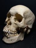 Human Skull with Linear Enamel Hypoplasia (LEH)