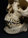 Human Skull with Linear Enamel Hypoplasia (LEH)