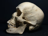 Human Skull with Linear Enamel Hypoplasia (LEH)