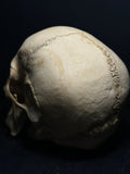 Human Skull with Linear Enamel Hypoplasia (LEH)