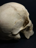 Human Skull with Linear Enamel Hypoplasia (LEH)