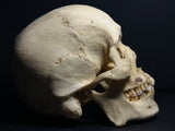 Human Skull with Linear Enamel Hypoplasia (LEH)