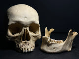 Human Skull with Linear Enamel Hypoplasia (LEH)