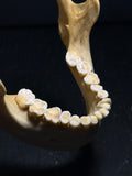 Human Skull with Linear Enamel Hypoplasia (LEH)