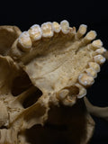 Human Skull with Linear Enamel Hypoplasia (LEH)