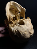 Human Skull with Linear Enamel Hypoplasia (LEH)