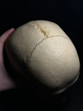 Human Skull with Linear Enamel Hypoplasia (LEH)