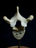 Human Vertebra Under Glass Dome
